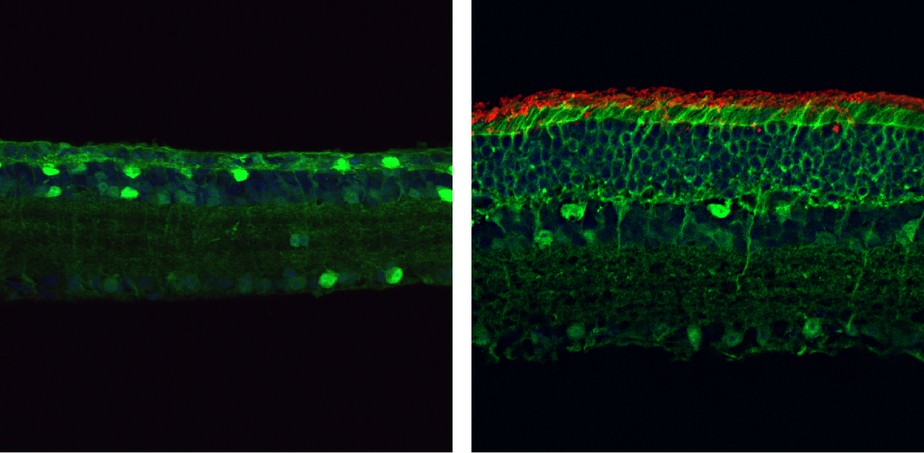 Imagens de microscópio das retinas de camundongos com retinite pigmentosa (esq.) e saudável (dir.)