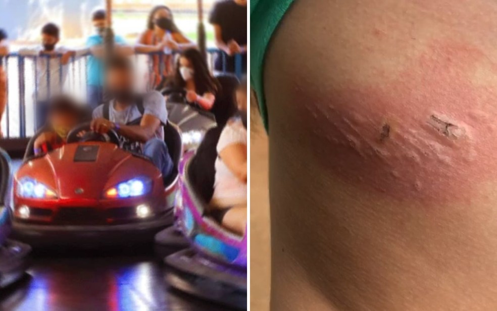 Adolescente sofre queimaduras após saírem faíscas de carrinho de bate-bate no Parque Mutirama, em Goiânia