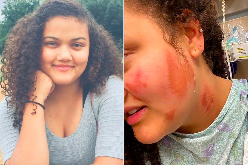 A adolescente Althea Bernstein foi vítima de ataque racista no estado do Wisconsin (Foto: Instagram)