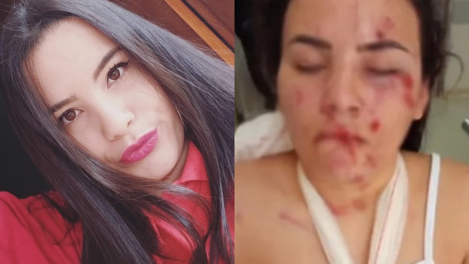 À direita, Mikaeli Gonçalves em foto publicada nas redes; à esquerda, o estado da jovem após as agressões