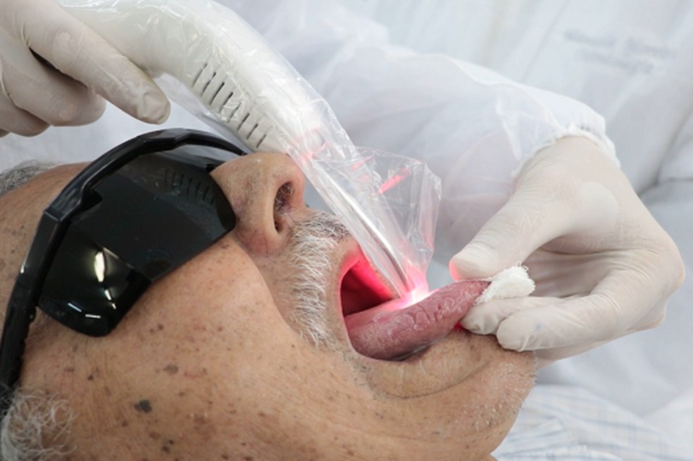Laserterapia é usada para ajudar na manutenção do paladar de pacientes em tratamento contra câncer, no Ceará. — Foto: UFCTV/Reprodução