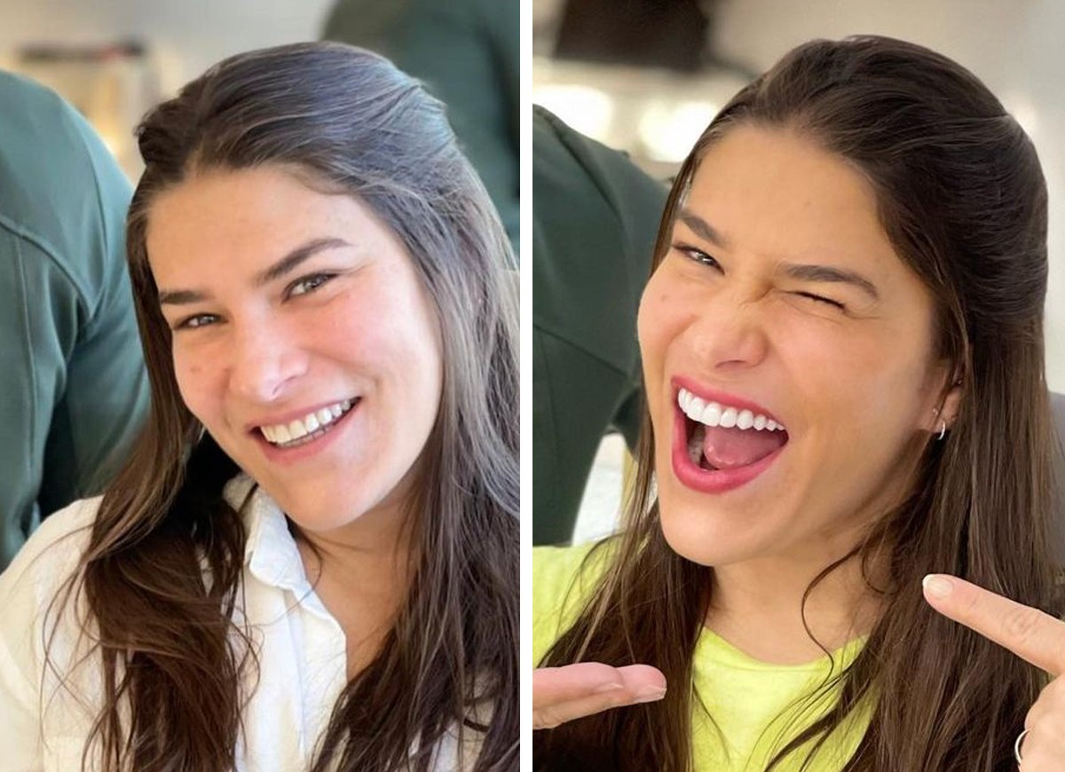 Priscila Fantin mostra antes e depois de lentes de contato nos dentesa (Foto: Reprodução Instagram)