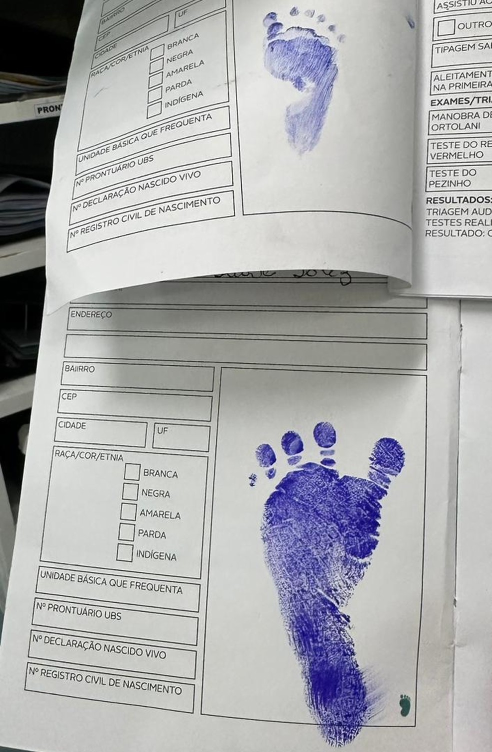 Diferença do tamanho de pezinhos. — Foto: Reprodução