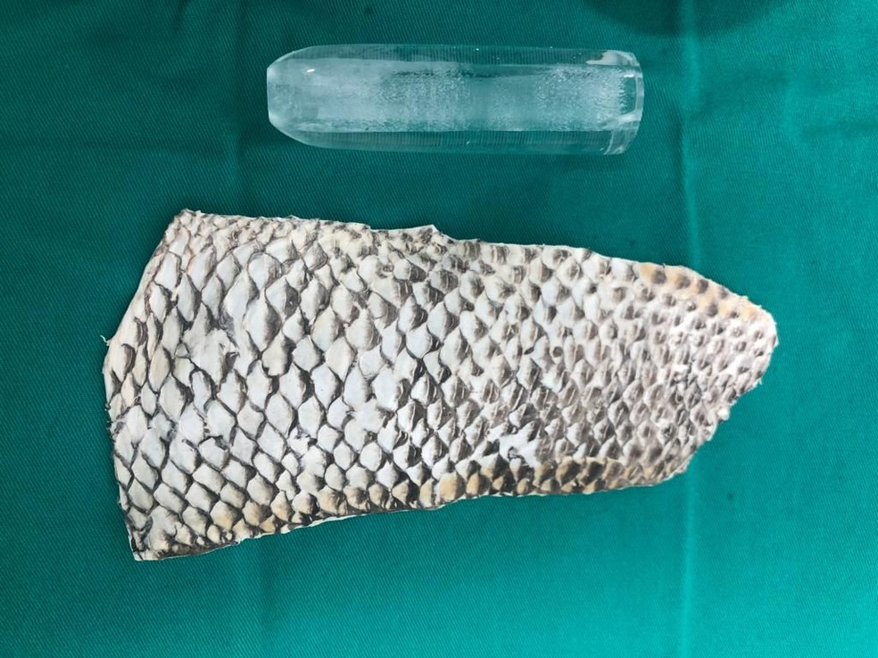 Molde de acrílico usado com a pele de tilápia no procedimento de construção do canal vaginal. — Foto: Divulgação