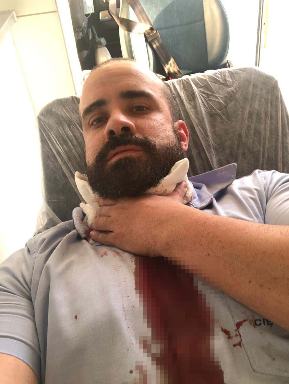 Engenheiro afirma que saía muito sangue do seu pescoço e que foi socorrido por ambulância em estrada — Foto: Arquivo pessoal 