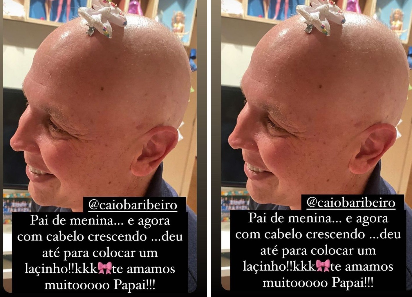 Caio Ribeiro compartilha foto com lacinh no cabeloa (Foto: Reprodução/Instagram)