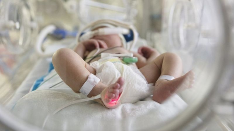 BBC - Desde início da pandemia, 420 bebês (crianças com menos de 1 ano) morreram em decorrência do novo coronavírus no Brasil, contra 45 nos Estados Unidos (Foto: Getty Images via BBC)