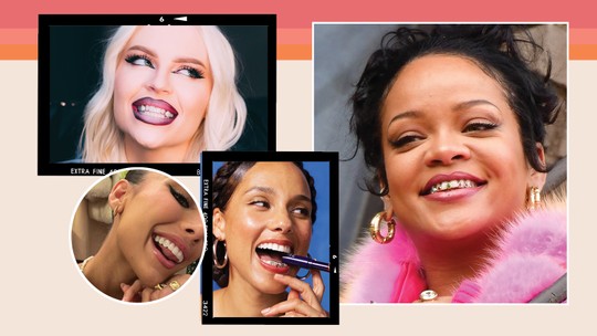 Piercing no dente e grillz: tudo sobre os acessórios milionários que conquistaram o sorriso das celebridades