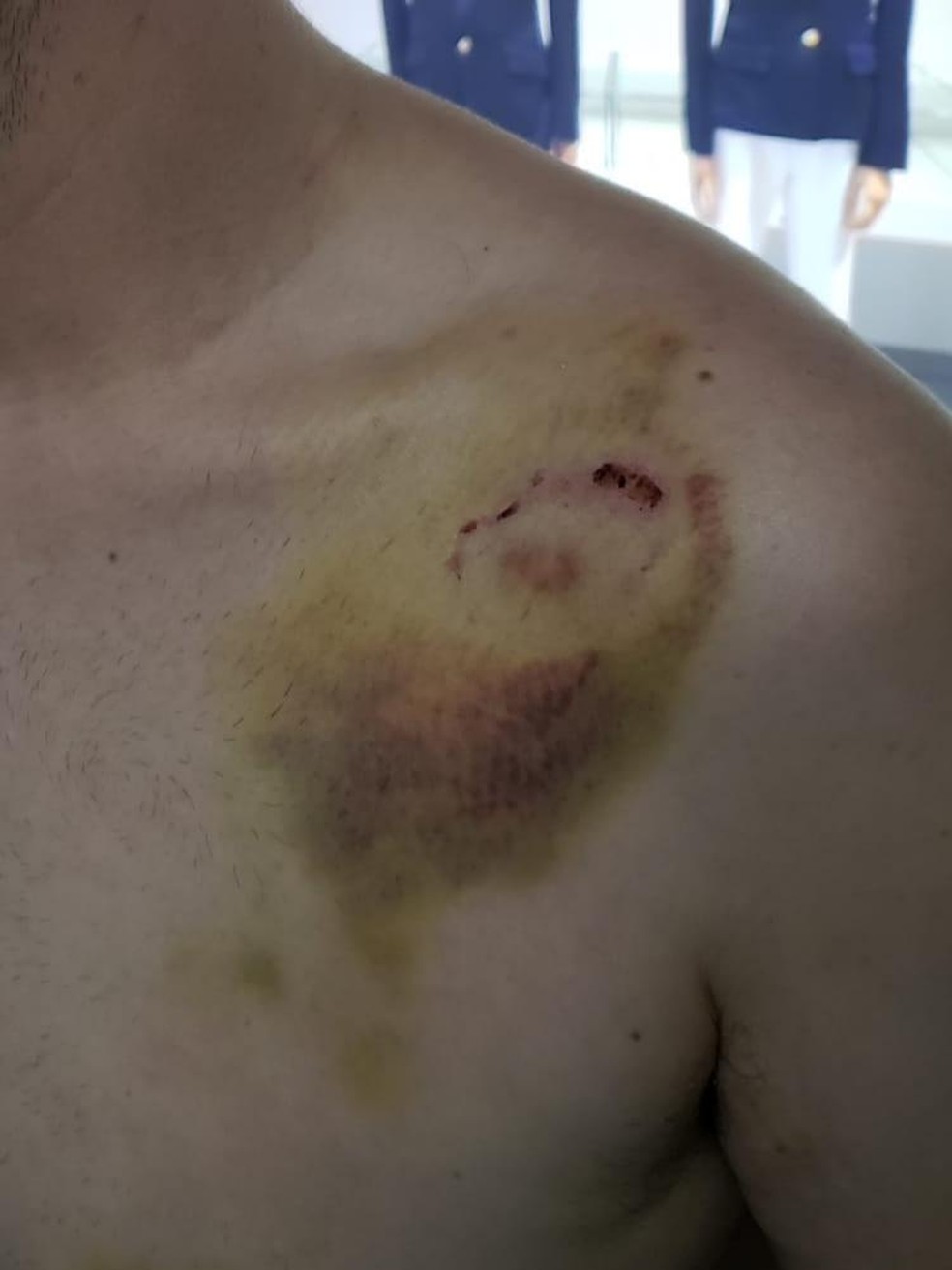 Homem registrou um boletim de ocorrência de lesão corporal contra Andressa — Foto: Eduardo/Arquivo Pessoal