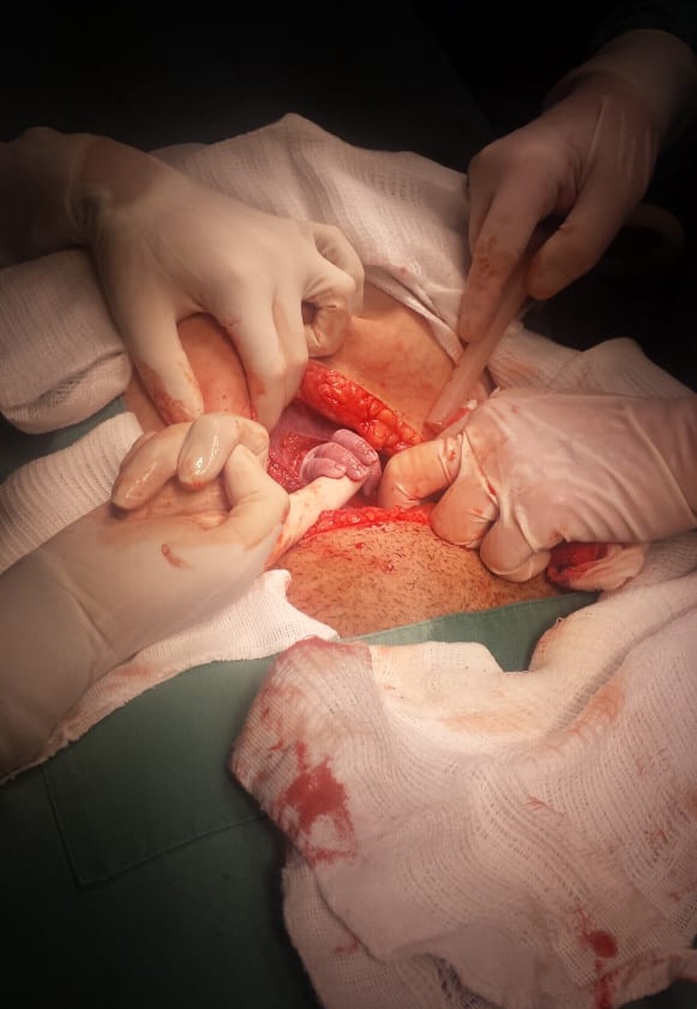 Avó registra momento em que bebê nasce e segura dedo de médica em MS — Foto: Ana Rego/Arquivo Pessoal