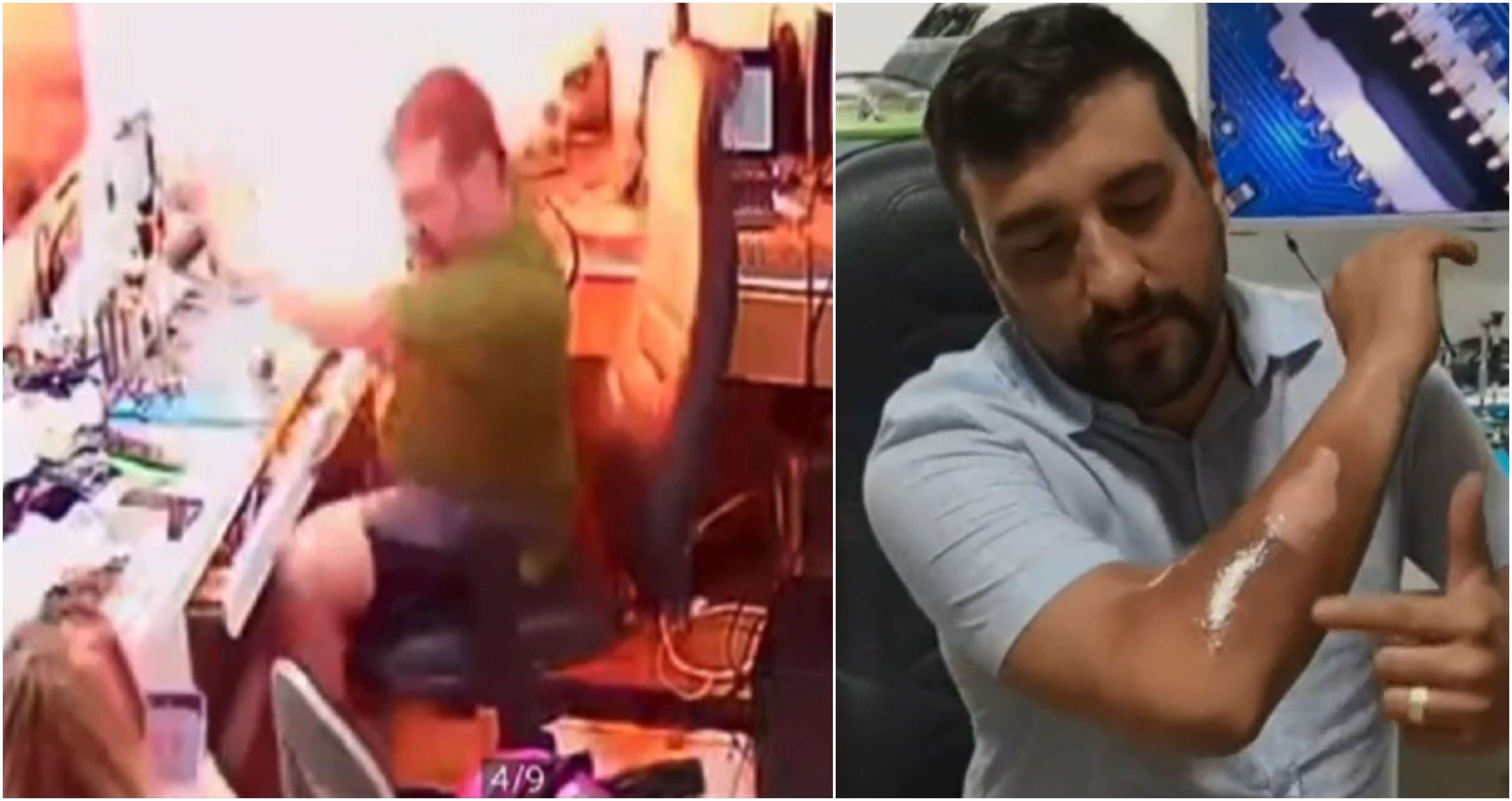 Celular explode e fere técnico que fazia reparos no Ceará; vídeo
