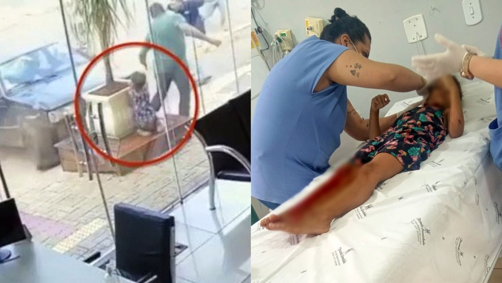 Maria Luiza precisou de atendimento médico após o acidente. — Foto: Reprodução/RedesSociais