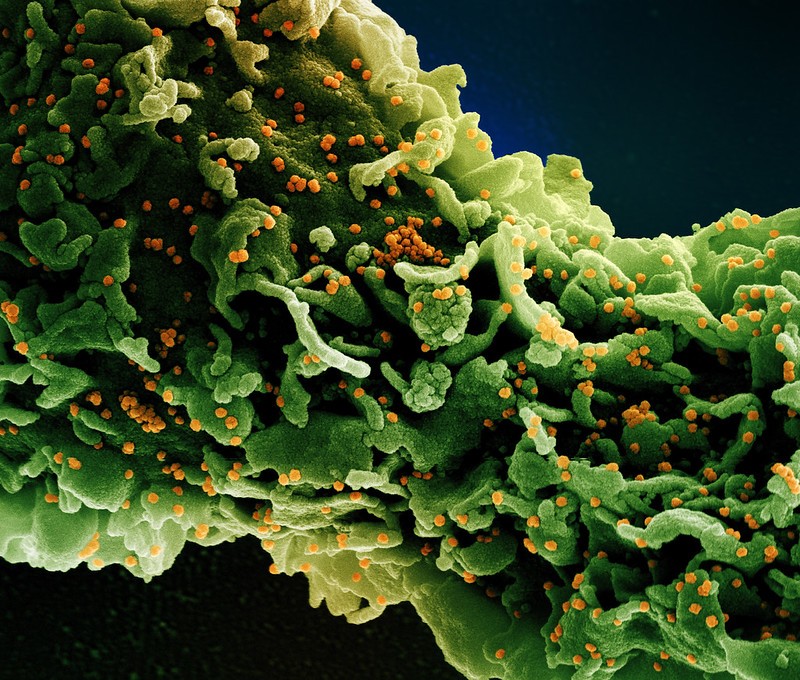 Micrografia eletrônica de varredura colorida de uma célula (verde) infectada com uma variante de partículas do vírus Sars-CoV-2 (Foto: NIAID)