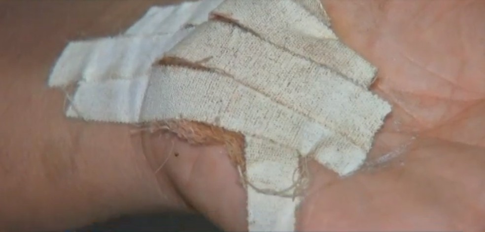 Vítima teve um corte na mão ao ser atingido por um golpe de faca — Foto: TVCA/Reprodução