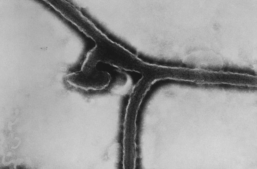 Imagem de detalhe do vírus de Marburg  — Foto: Arquivo/Dr. Fredrick Murphy/Sylvia Whitfield/CDC