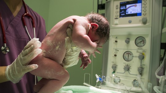 Asfixia perinatal: o que acontece quando "falta oxigênio" no parto, no nascimento ou nos primeiros minutos de vida do bebê
