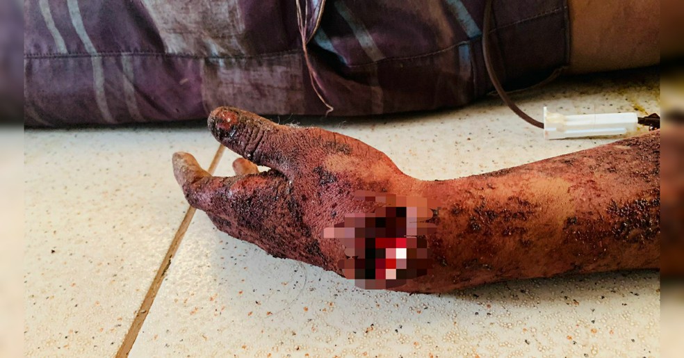 Corpo do homem não identificado apresentava vários ferimentos pelo corpo — Foto: Blog do Pião