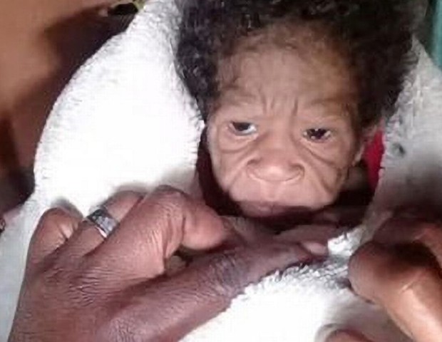 Bebê nasce com condição rara que causa envelhecimento precoce, na Àfrica do Sul (Foto: Reprodução/Mirror)