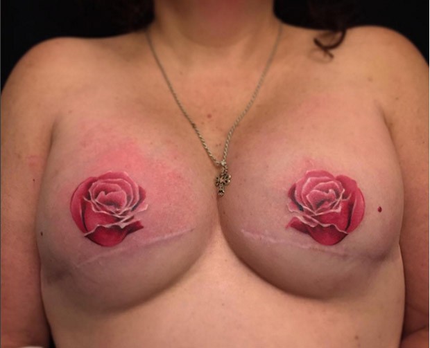 Clientes do estúdio da tatuadora Amy Black também costumam publicar fotos de suas tatuagens pós-mastectomia (Foto: Reprodução / Instagram)