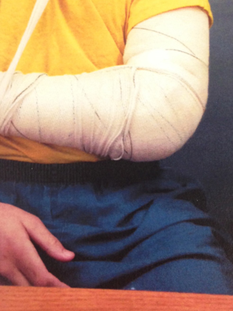 Adolescente interno da Fundação Casa com marcas de agressão  — Foto: Defensoria Pública