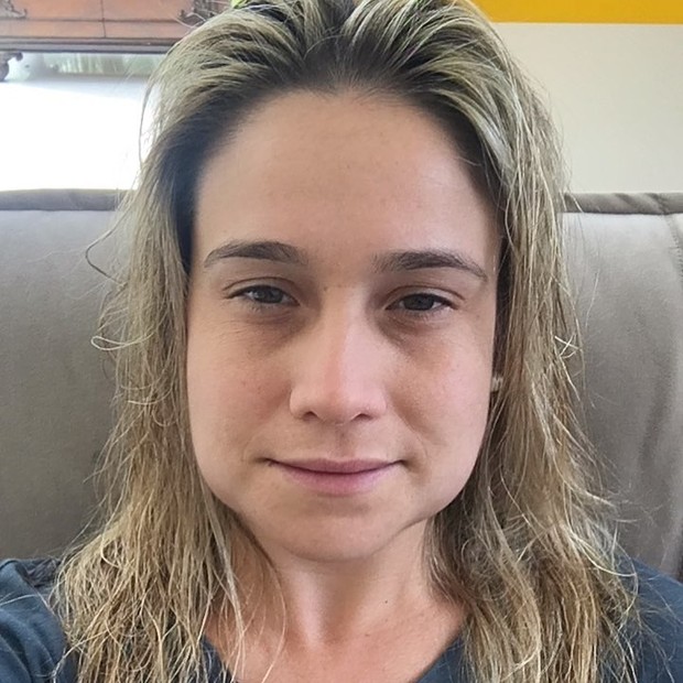 Fernanda Gentil posa após tirar 4 sisos (Foto: Reprodução/Instagram)