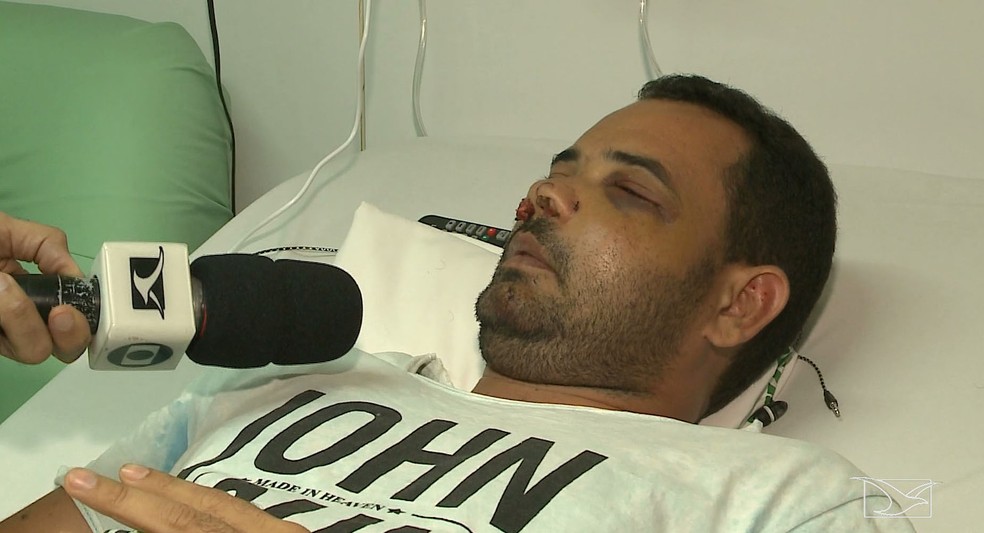 Anderson Pereira da Silva foi espancado pelo policial militar Eduardo da Luz Soares em São Luís — Foto: Reprodução/TV Mirante