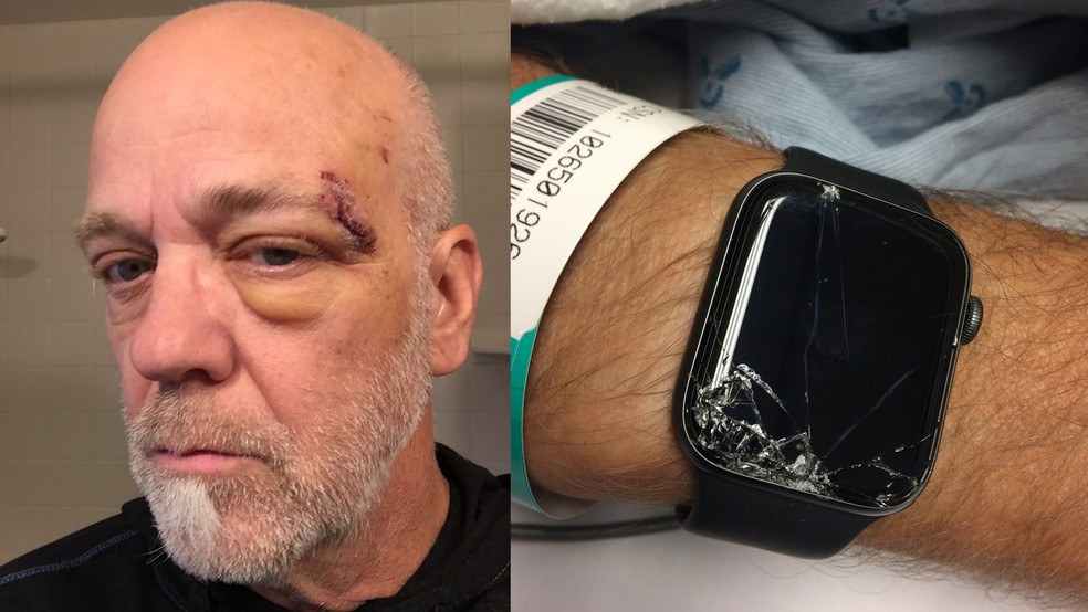Bob Burdett sofreu queda violenta; Apple Watch alertou serviço de socorro — Foto: Reprodução/Gabe Burdett