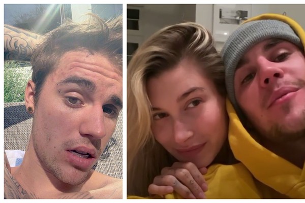 A modelo Hailey Baldwin Bieber ajudou o marido, Justin Bieber, em sua rotina de cuidados com a pele (Foto: Instagram)