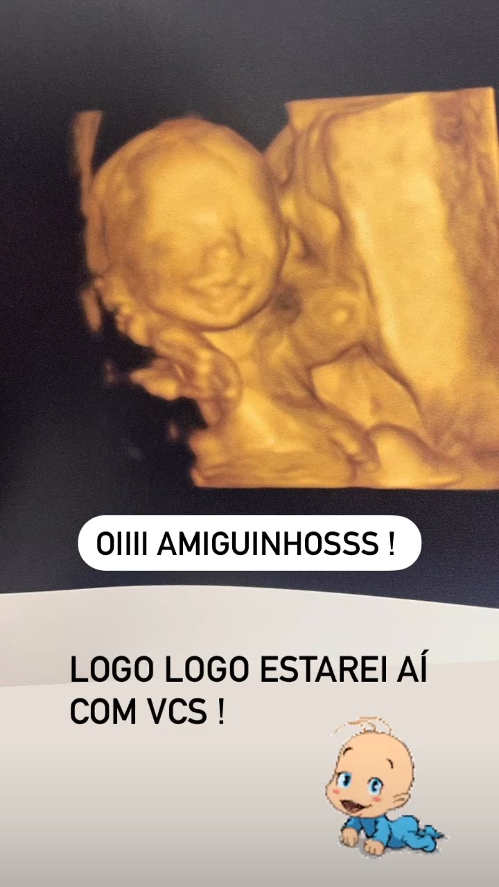 Bia Feres mostra ultrassom de Isaac (Foto: Reprodução / Instagram)