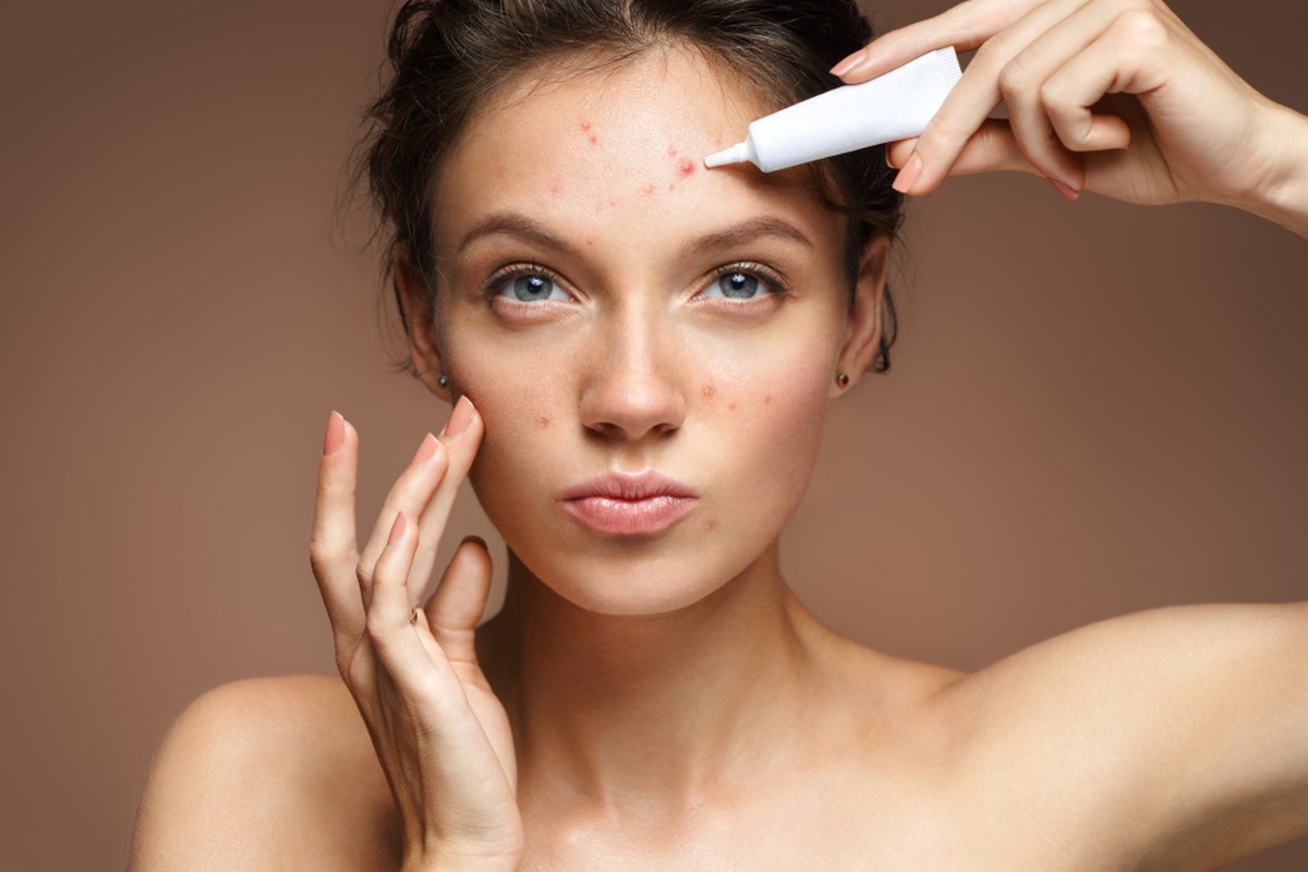 Rosacea Causes Symptoms Diagnosis Treatment