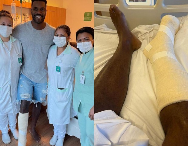 Rafael Zulu engessa perna após lesão (Foto: Reprodução/Instagram)