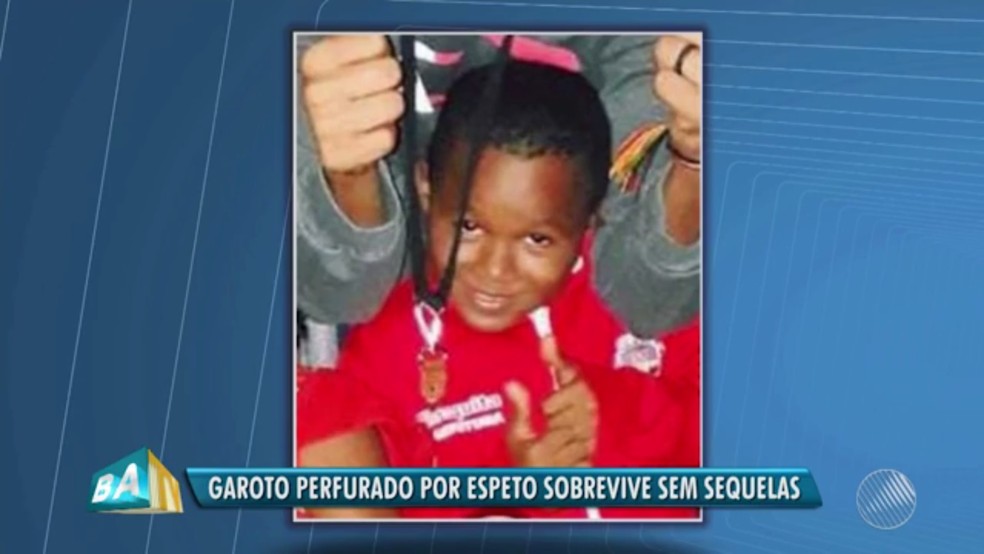 Menino teve cérebro perfurado por espeto (Foto: Reprodução/TV Bahia)
