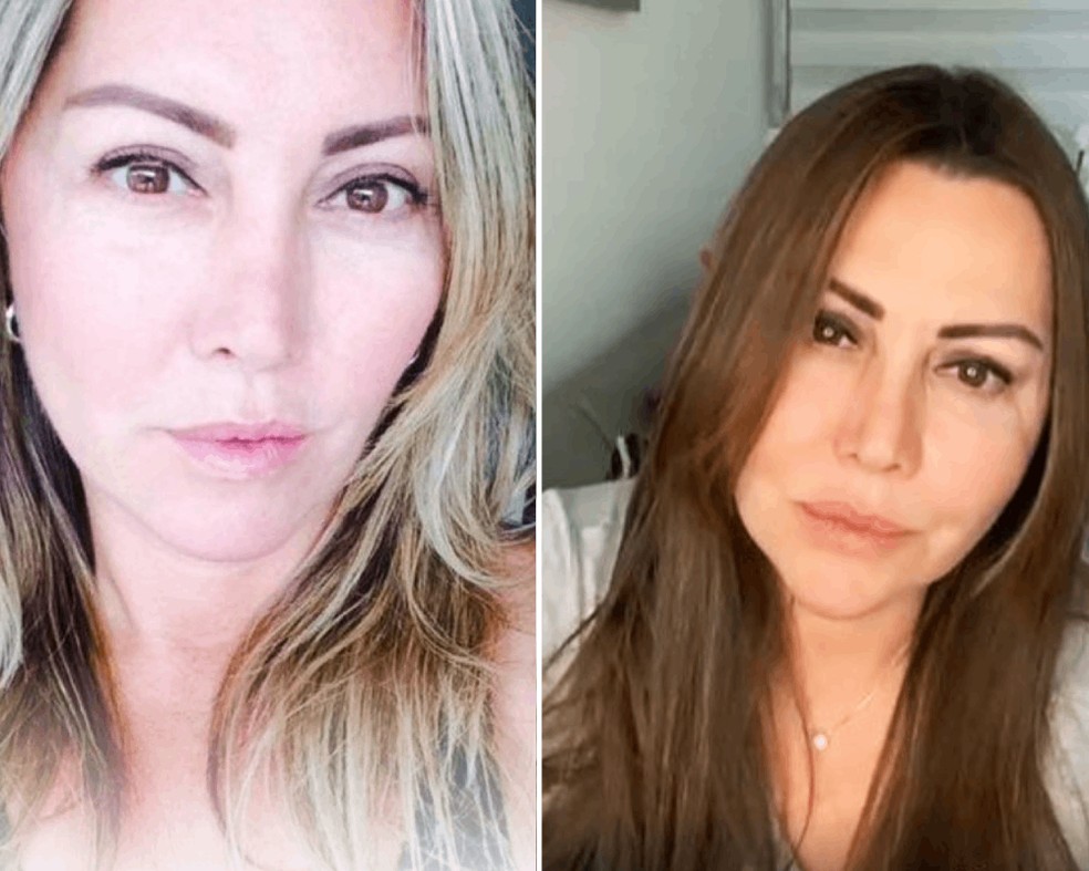 Elaine Caparróz antes e depois: tentativa de reconstruir o rosto e a vida depois de tentativa de feminicídio — Foto: Reprodução/Redes sociais
