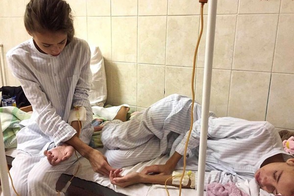 As modelo gêmeas russas Masha e Dasha Ledeneva foram hospitalizadas por excesso de perda de peso (Foto: Reprodução)