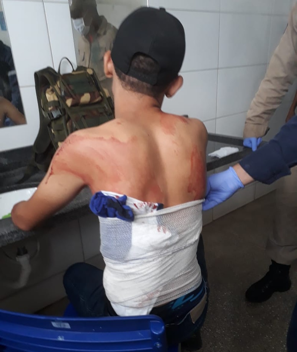 Aluno de 18 anos foi esfaqueado nas costas — Foto: PM-MT/ Divulgação