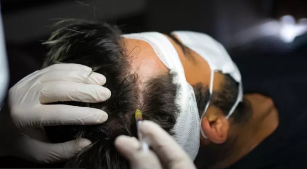 Inflitração com medicamentos e vitaminas no couro cabeludo é opção de tratamento a depender do diagnóstico do paciente (Foto: BYAKKAYA/GETTY IMAGES)