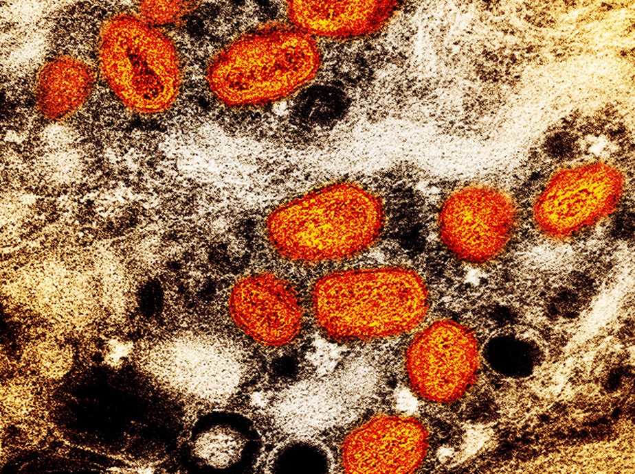 Micrografia eletrônica de transmissão colorida de partículas do vírus da varíola dos macacos (laranja) encontradas dentro de uma célula infectada (marrom), cultivadas em laboratório.