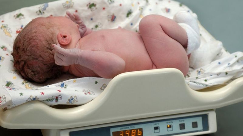 'BebÃª estava gordinho, mas anÃªmico': crianÃ§as sofrem com alta de desnutriÃ§Ã£o e excesso de peso