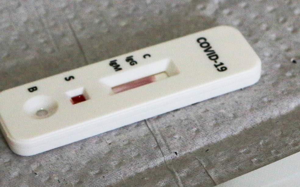 Exemplo do dispositivo usado teste rápido para o coronavírus — Foto: Divulgação/Dayse Euzébio/Secom-JP
