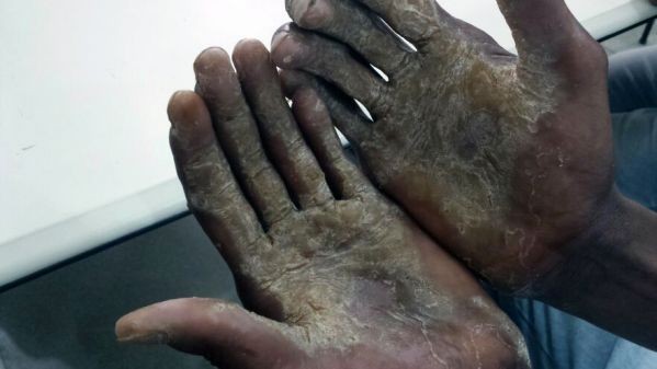 'Lista Suja' do trabalho escravo traz 13 empregadores da BA; agropecuária é atividade com maior incidência
