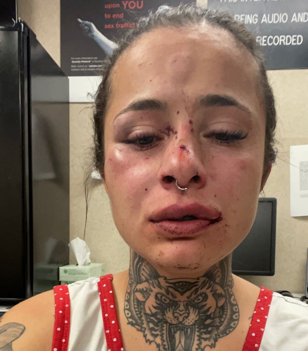 Tatuadora brasileira é espancada pelo namorado em Las Vegas — Foto: Reprodução/Redes sociais