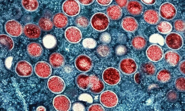 Micrografia eletrônica do vírus da varíola do macaco (vermelho)