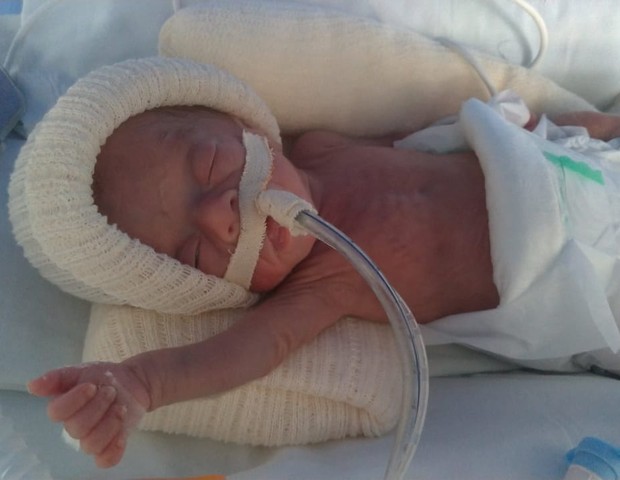 Serena Lis Procópio nasce com 26 semanas  (Foto: Arquivo Pessoal )