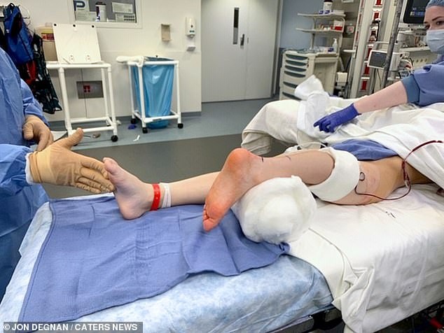 A perna foi recolocada ao contrário (Foto: Reprodução/Daily Mail)