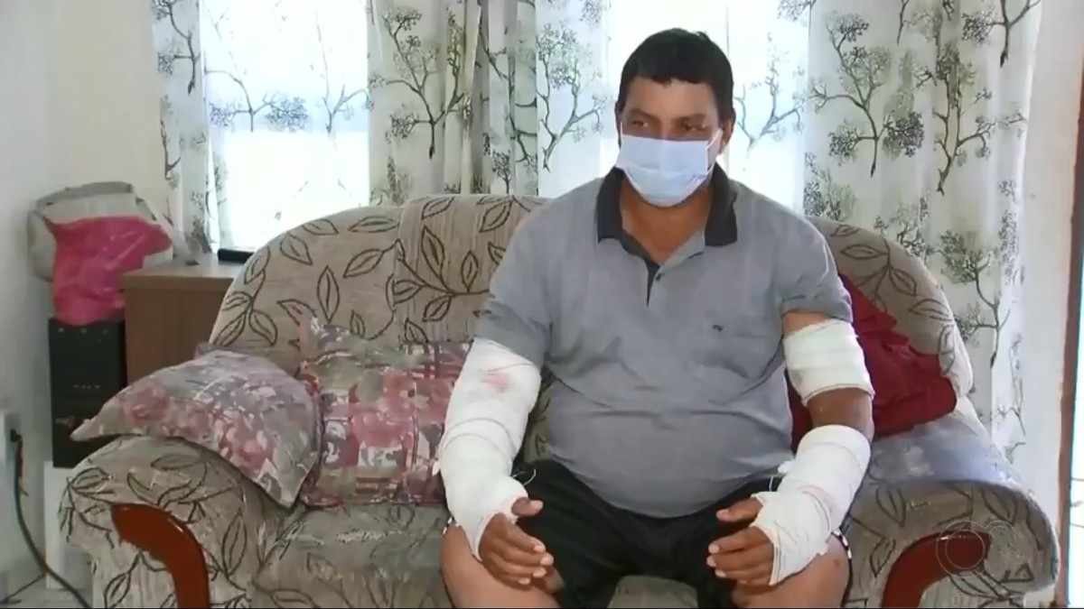 Vereador atacado por pitbull que escapou de casa diz que ...