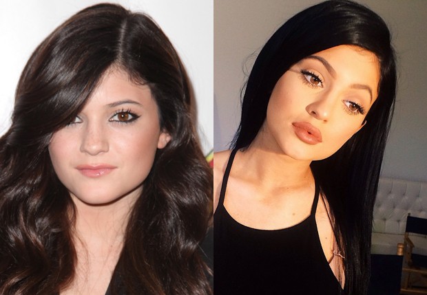 Kylie Jenner em 2010 e em 2014 (Foto: getty Images e Reprodução/Instagram)