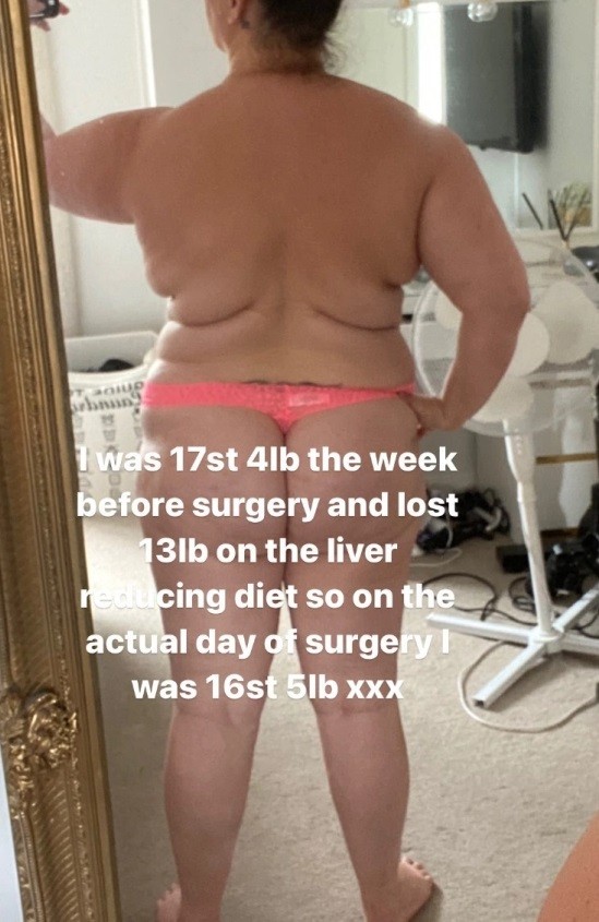 Um post de Chanelle Hayes no Instagram mostrando o corpo dela há um ano (Foto: Instagram)