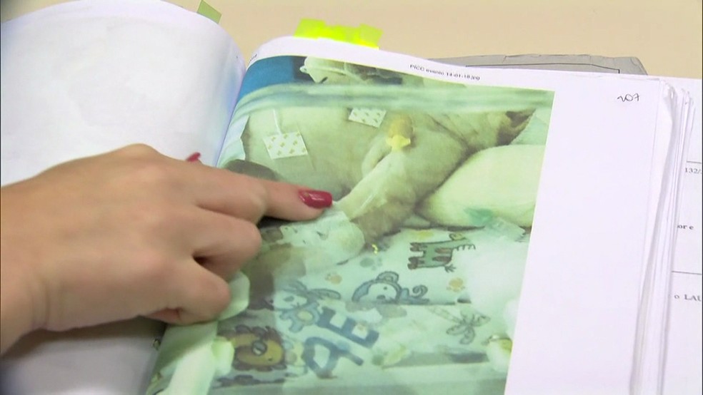 Bebês aparecem em fotos com braços machucados (Foto: Reprodução / TV Globo)