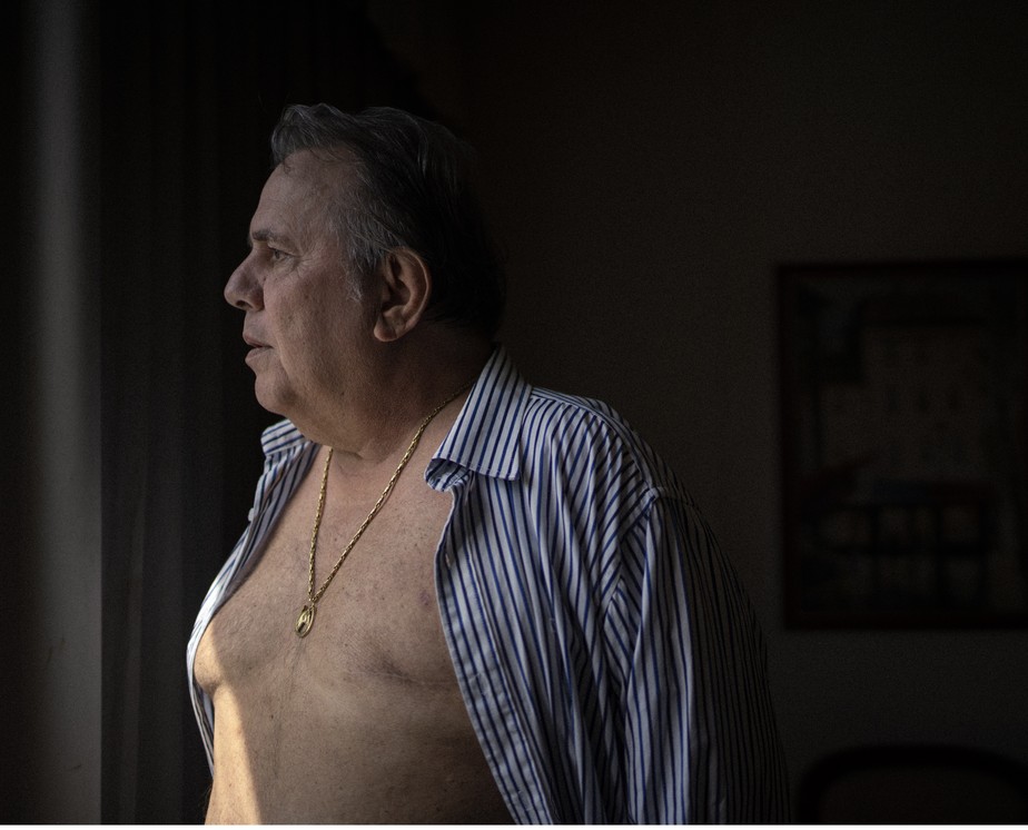 Carlos Eduardo Coelho, 68, levou um susto ao ser diagnosticado com câncer de mama em setembro do ano passado