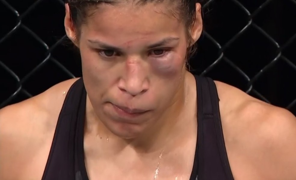 Julianna PeÃ±a apresenta inchaÃ§o no olho esquerdo no UFC Sacramento â?? Foto: ReproduÃ§Ã£o / Combate